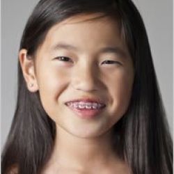 Davison Orthodontics early prevention